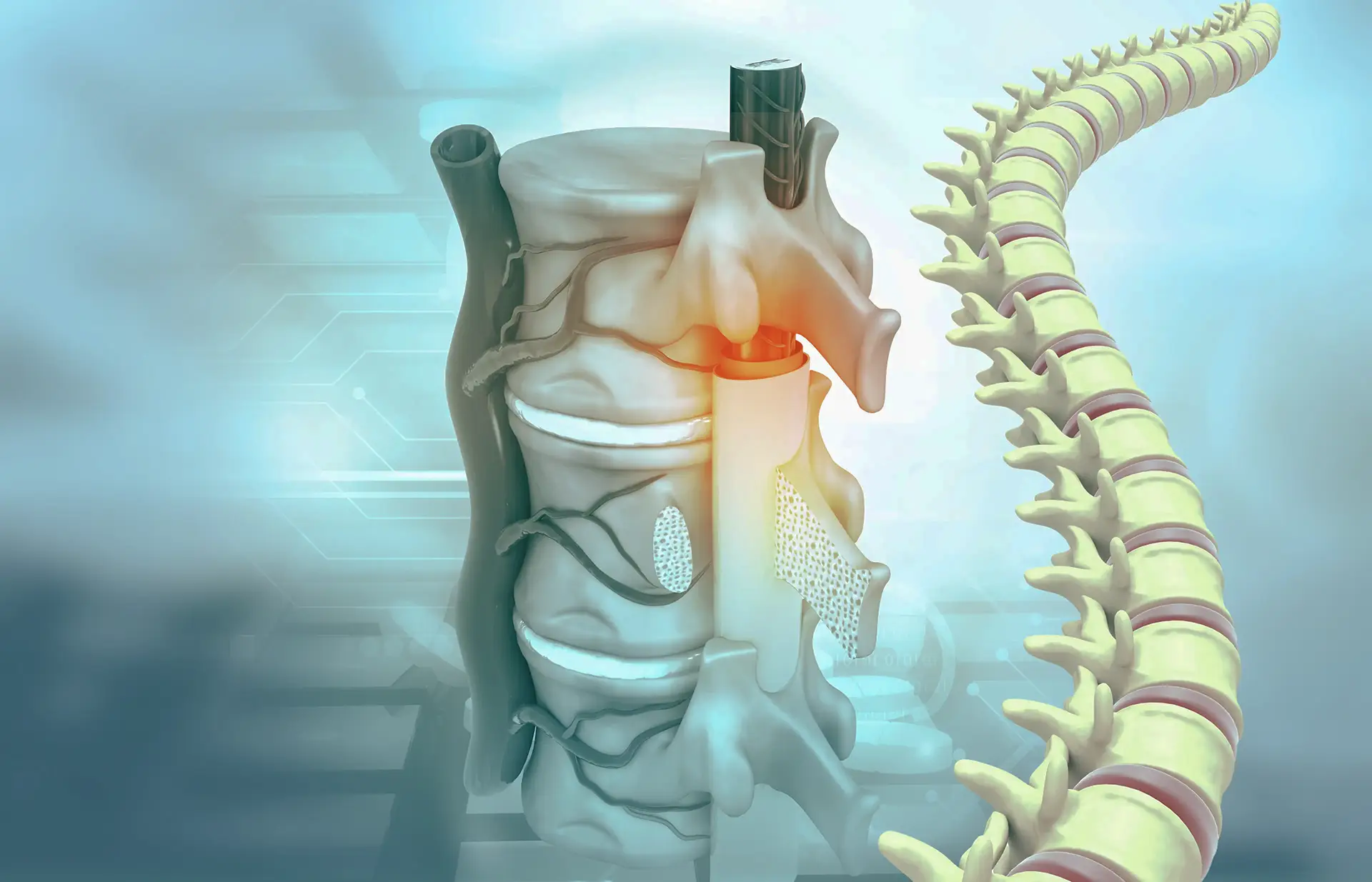 Spinal Stenosis Treatment